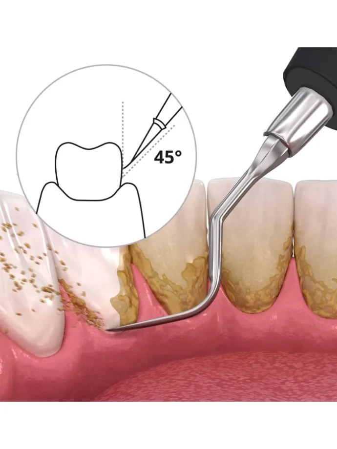 DEPLAQUED Schall-Zahnreiniger in schwarz