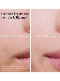 IPL-Haarentfernungsgerät